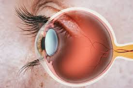 نتایج امیدوارکننده یک روش جدید ژن‌درمانی برای بازگرداندن بینایی